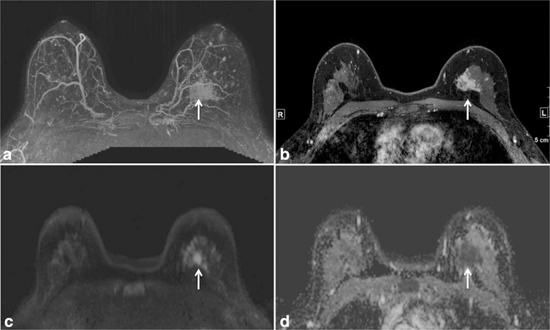 Figure 12.