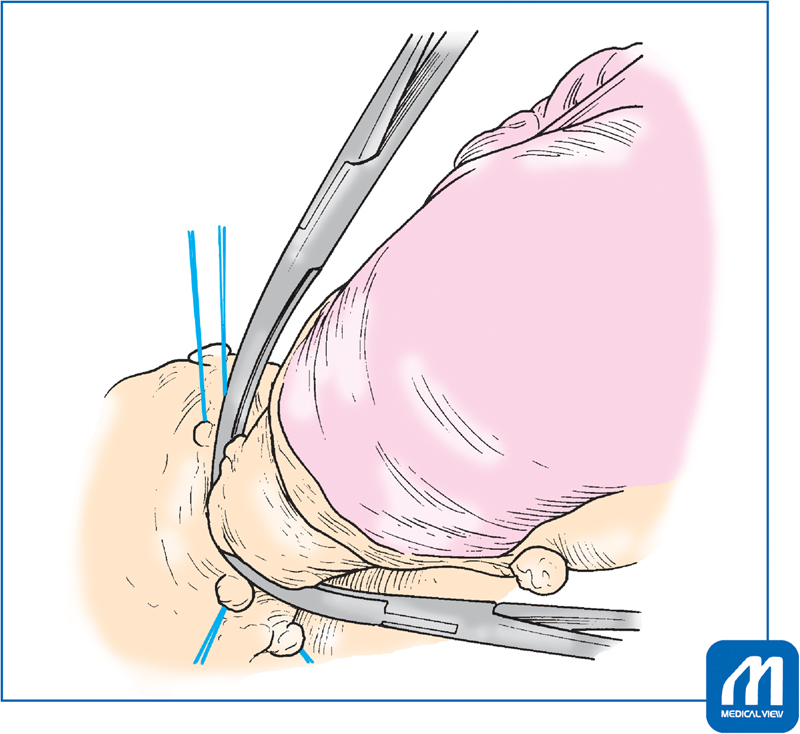 Fig. 13