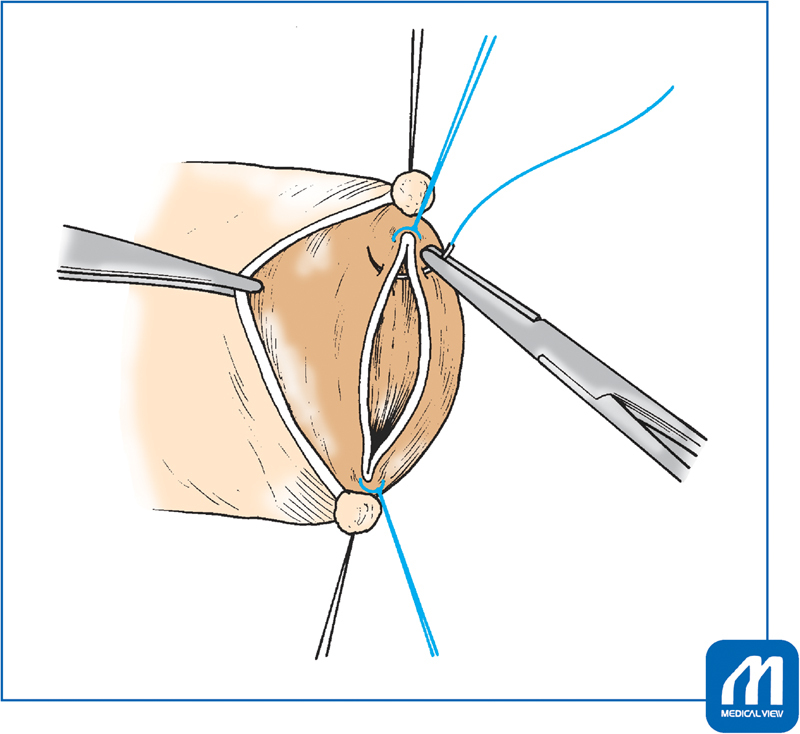 Fig. 15