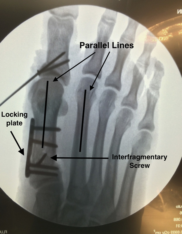 FIGURE 20