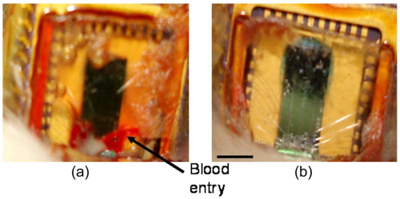 Fig. 11