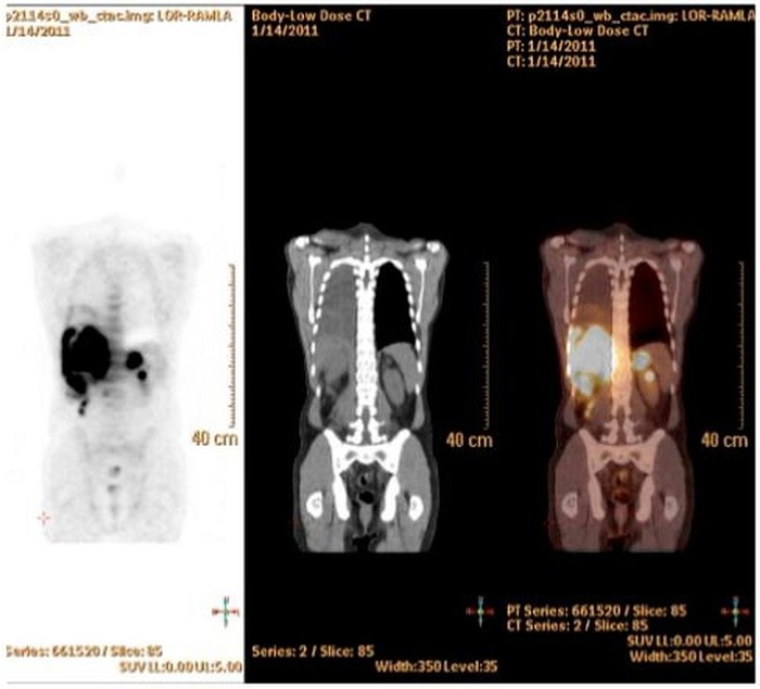 Figure 2