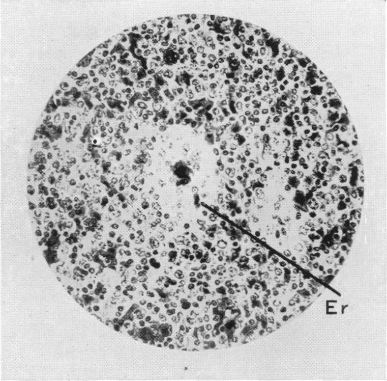 Fig. 14