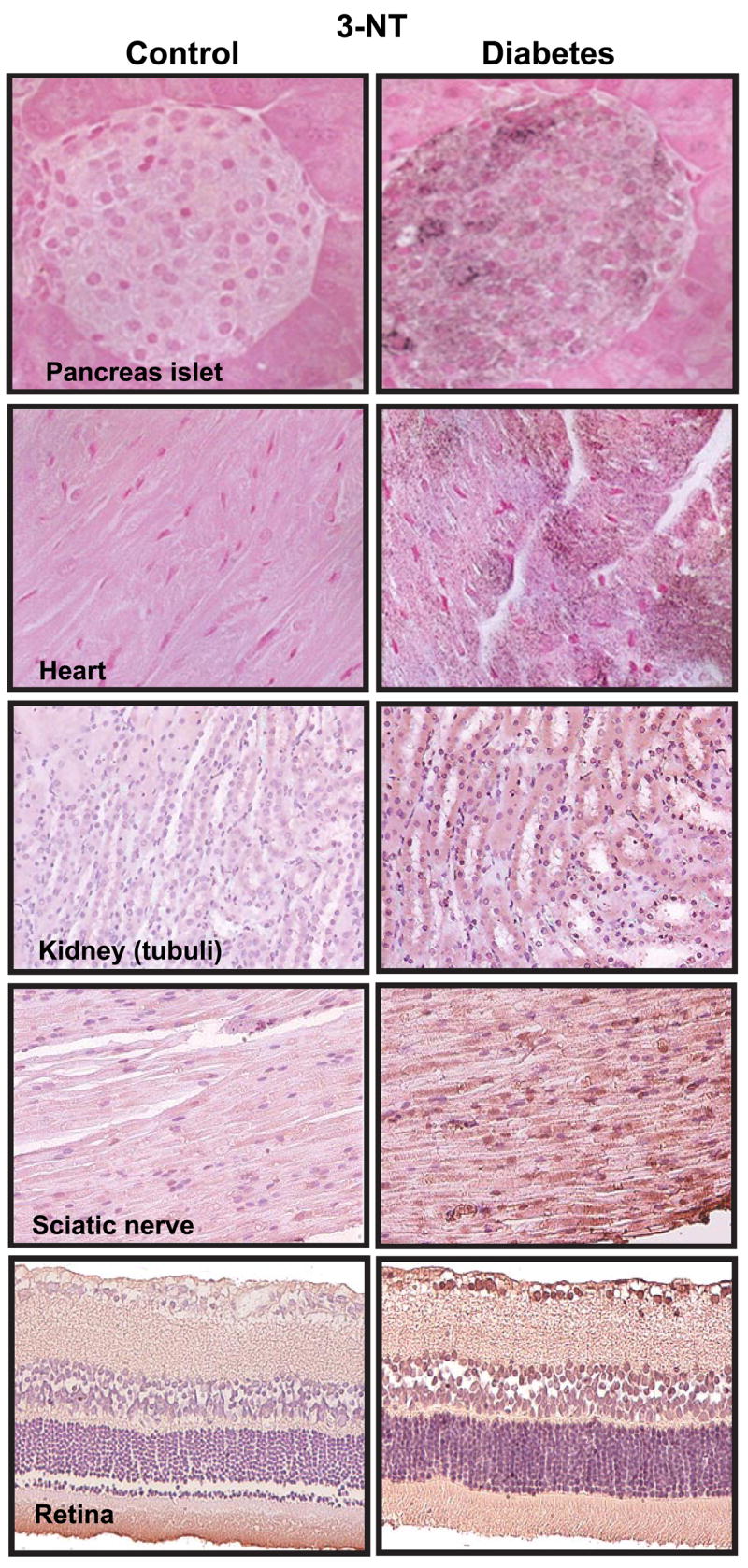 FIG. 16