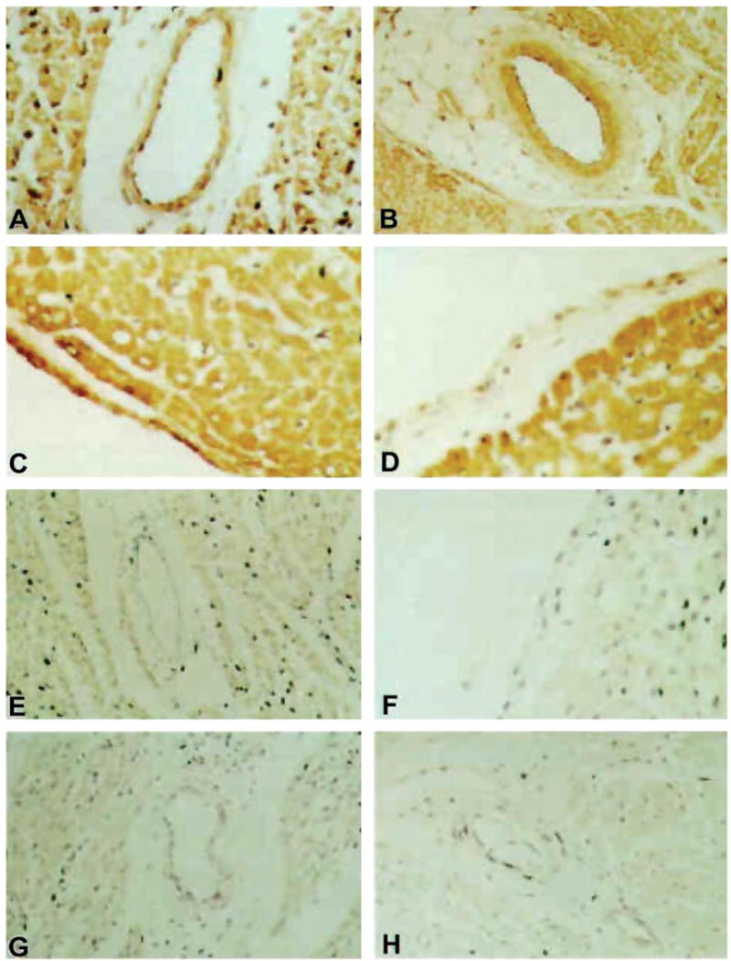 FIG. 11