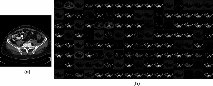 Fig. 9