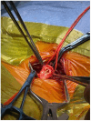 Fig 3