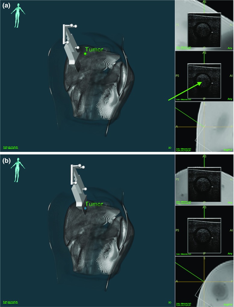 Fig. 4