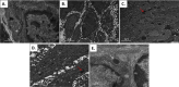 Fig 10