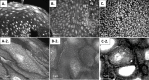 Fig 11