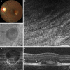 Figure 15