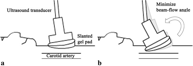 Fig. 2