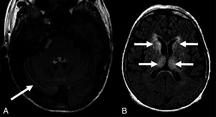 FIG 3.