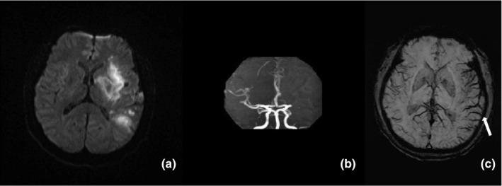 FIGURE 2