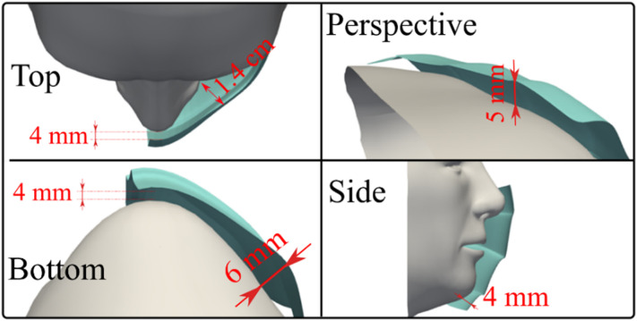 Fig. 20