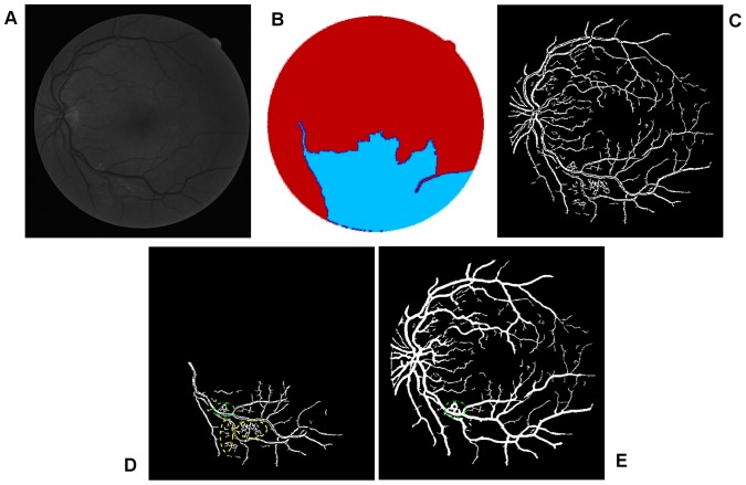 Figure 11