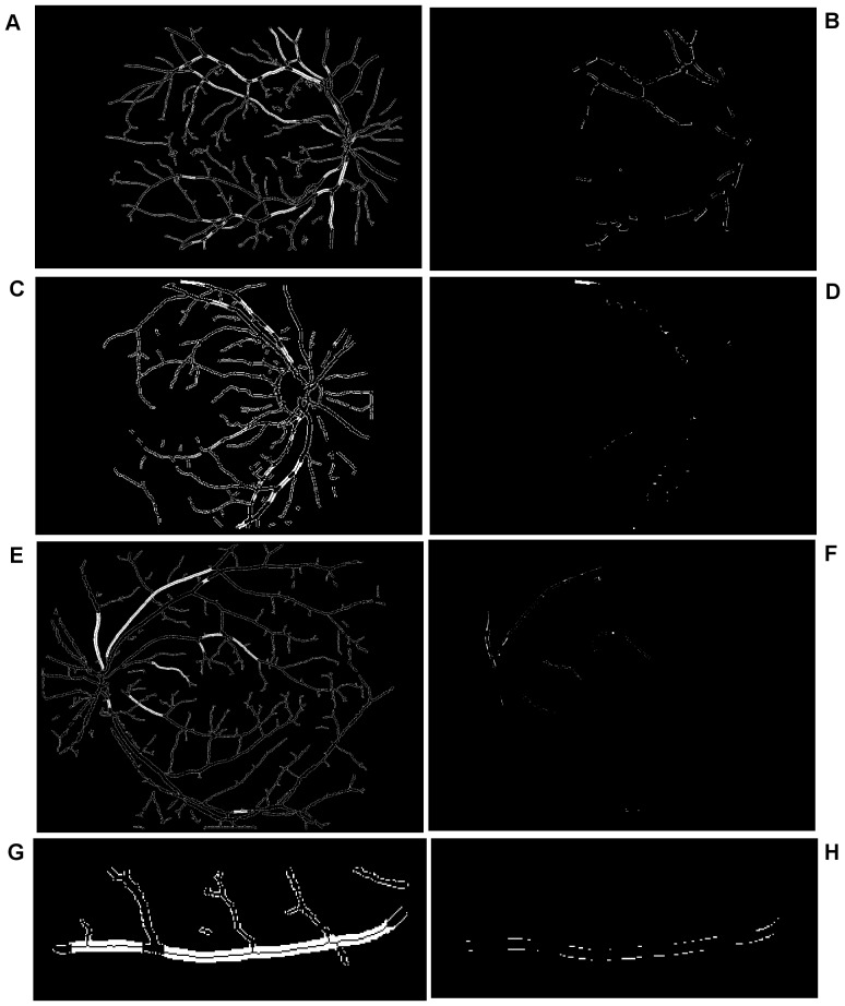 Figure 14