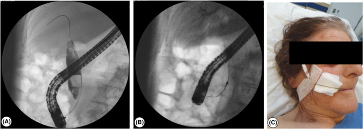 FIGURE 1