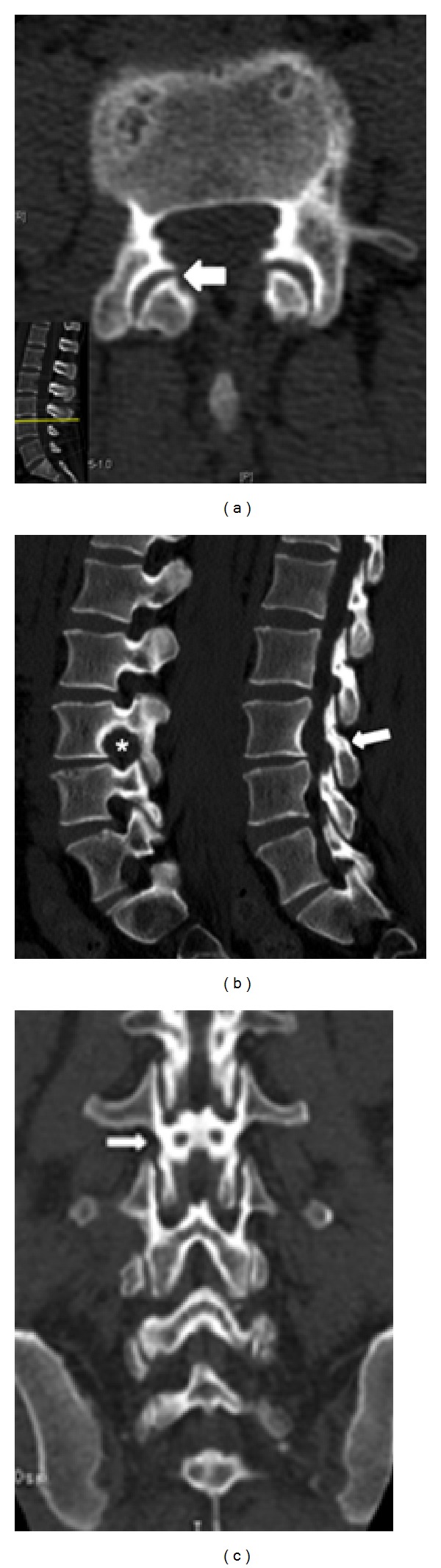 Figure 10