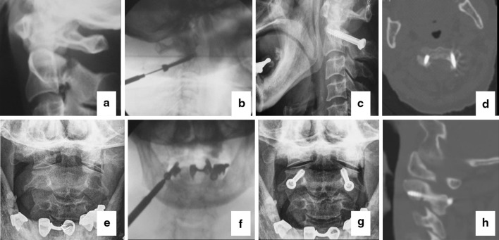 Fig. 5