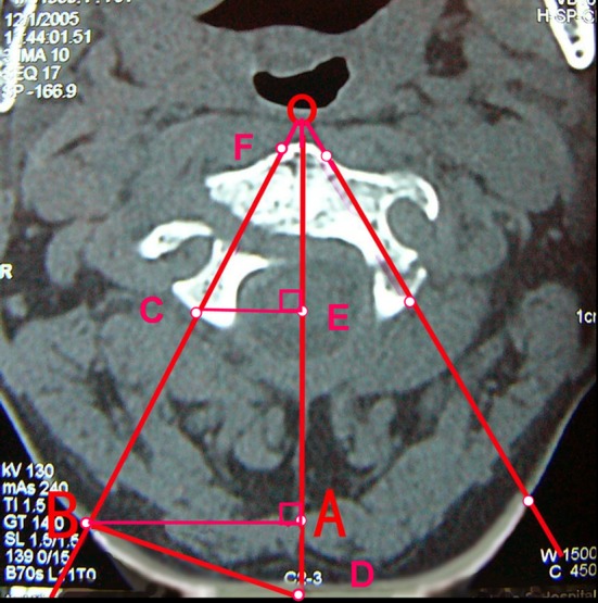 Fig. 1