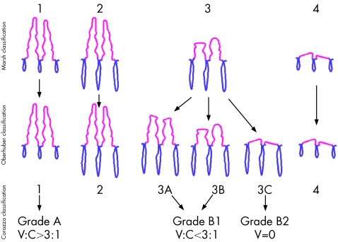 graphic file with name cp31260.f4.jpg