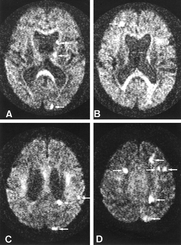 fig 2.