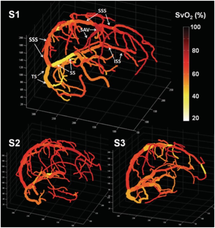 Figure 11.