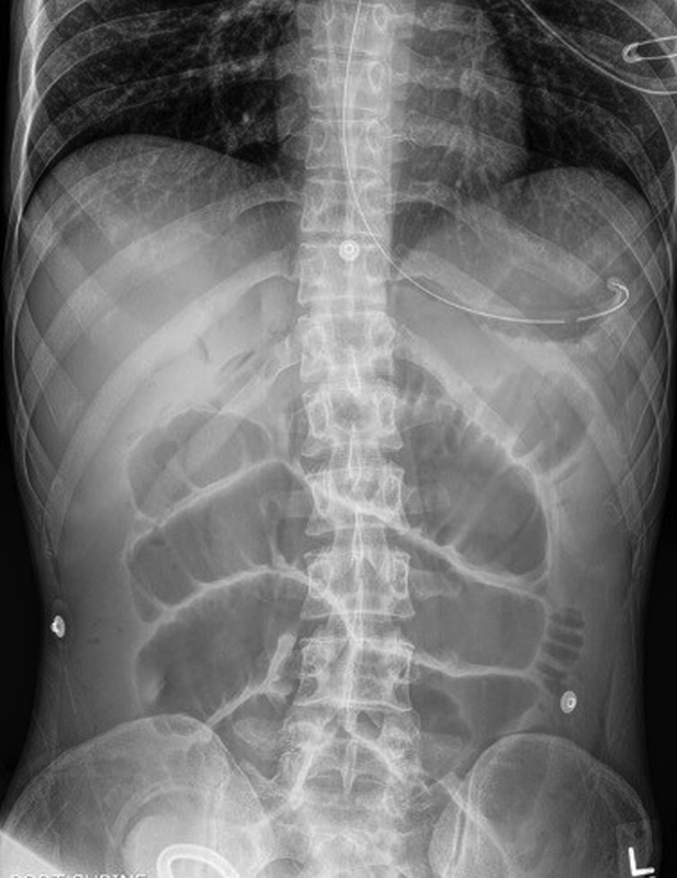 Fig. 5