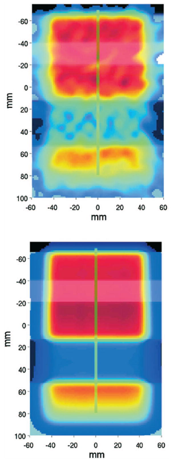 Fig. 11