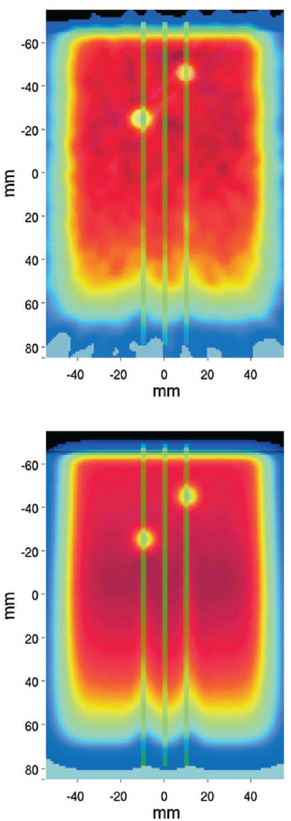 Fig. 12