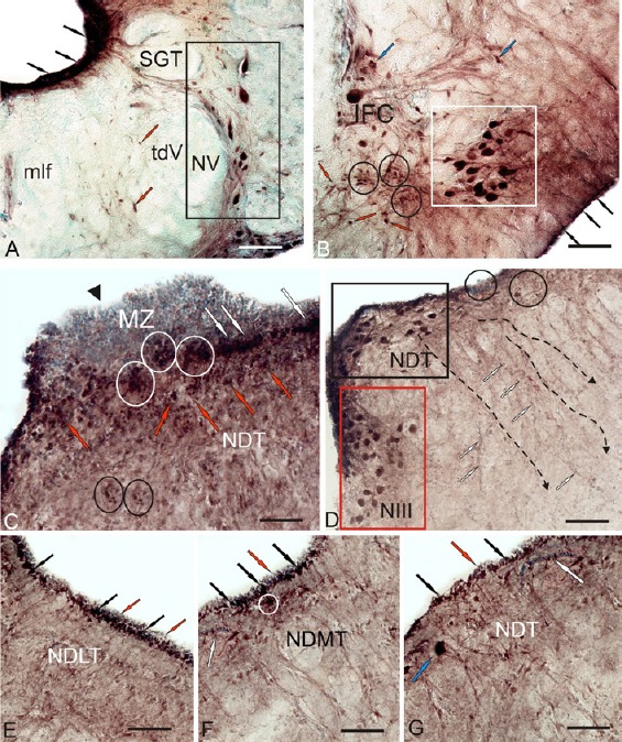 Figure 12