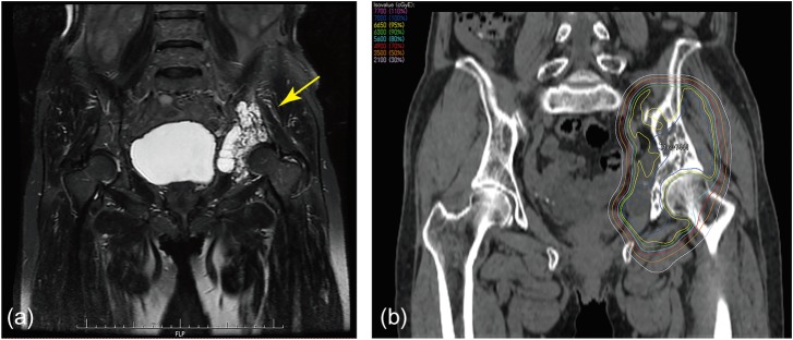 Fig. 3.