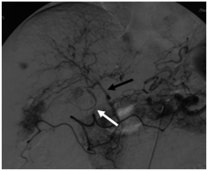 Figure 13.