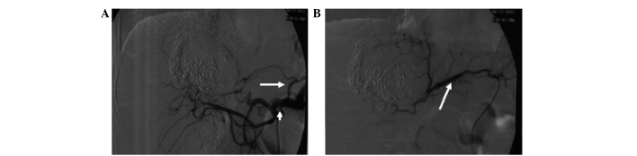 Figure 12.