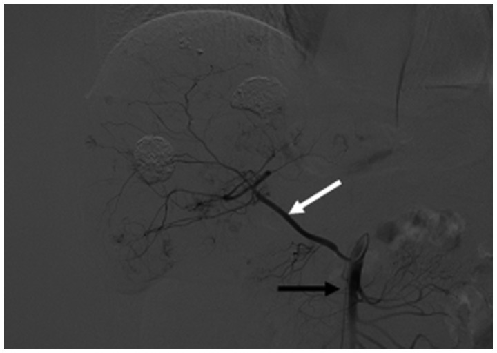 Figure 14.