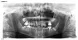 Fig. (1)