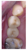 Fig. (4)