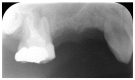 Fig. (2)