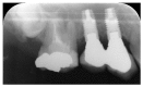 Fig. (6)
