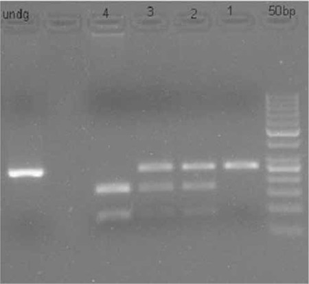 Patient With Mutation In The Matrix Metalloproteinase 2 (mmp2) Gene - A 