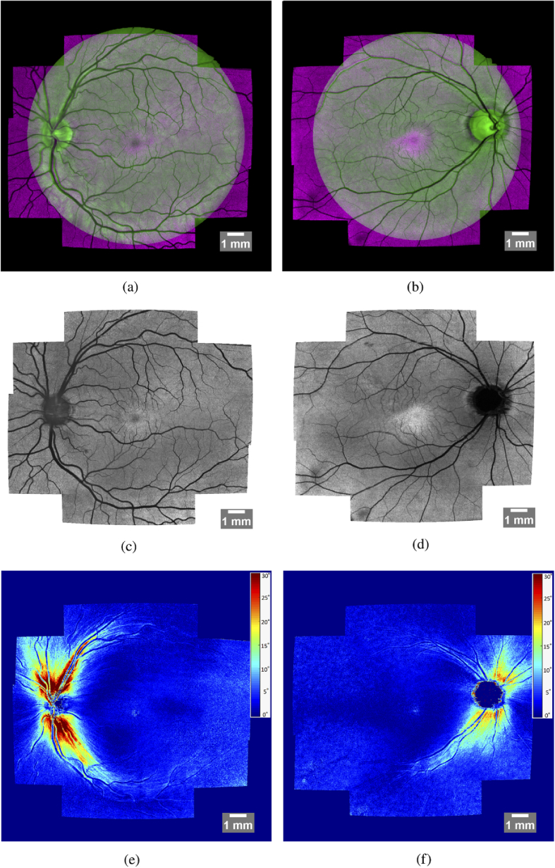 Fig. 12.