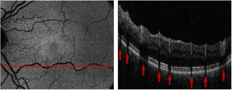 Fig. 4.