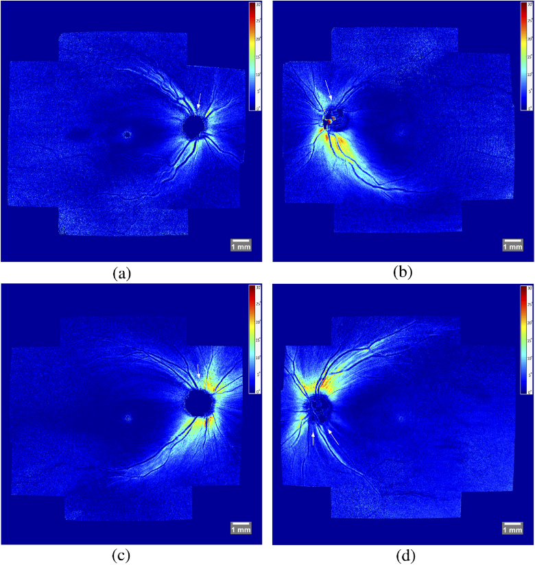 Fig. 13.