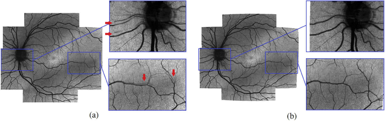 Fig. 11.