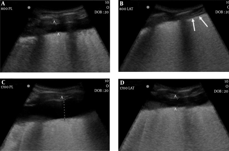 Figure 4.