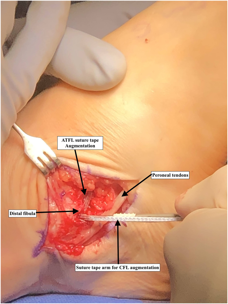 Fig 1