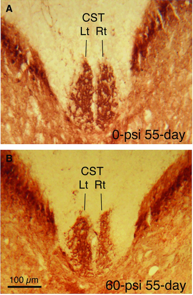 FIG. 11.