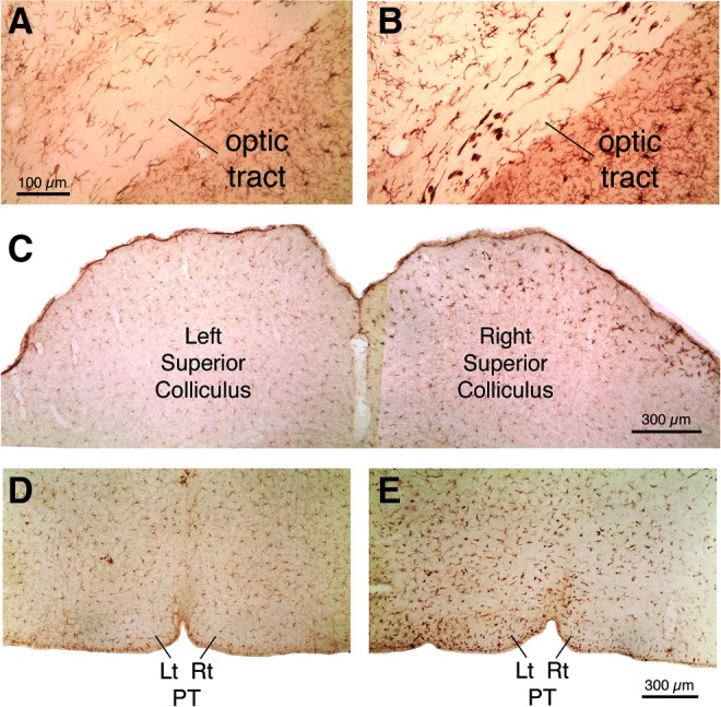 FIG. 12.