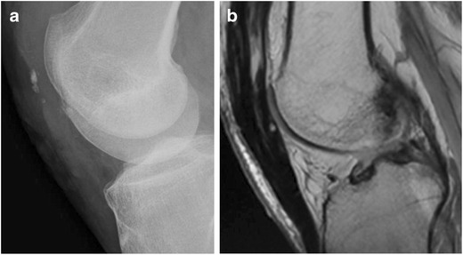Fig. 14
